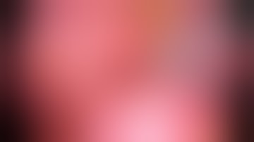 Laparoscopic Excision of Choledochal Cyst with Hepaticojejunostomy Jejunojejunostomy