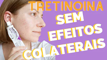 Quanto tempo usar Tretinoína?