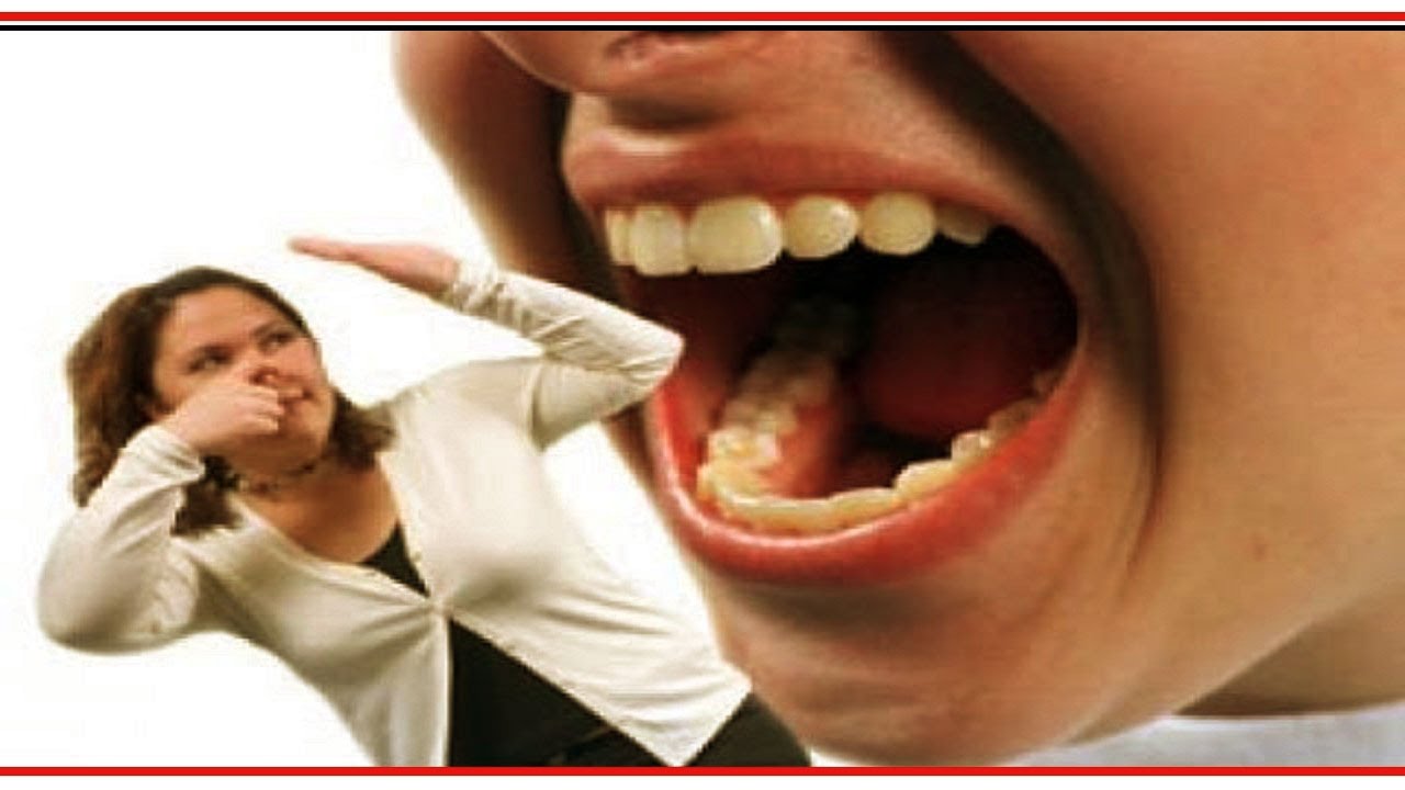 почему плохо пахнет изо рта. рот закрыт. запах из зо рта причины. неприятный запас изо рта. запах изо рта у человека.