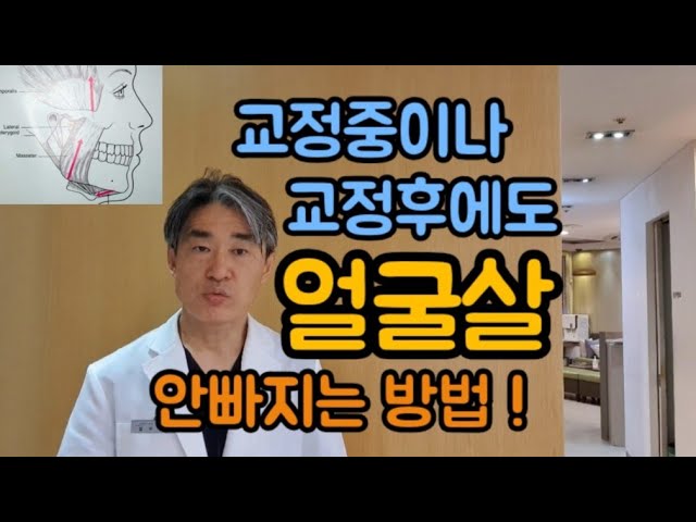 치아교정중이나 후에도 얼굴살 안빠지는 방법!