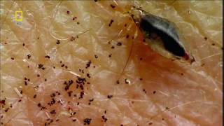 Нательная вошь (Pediculus corporis) под микроскопом