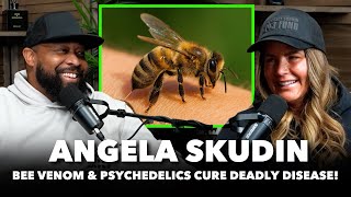 “Bee Venom Saved Me” - Angela Skudin's INCREDIBLE COMEBACK From a DEADLY Disease & Tragic Loss