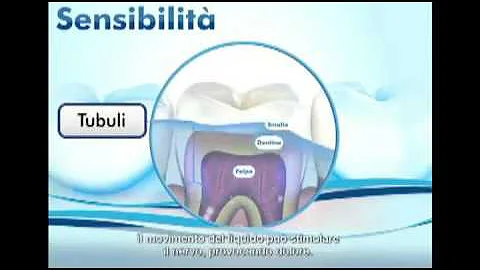 Come capire se hai i denti sensibili?