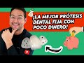 ¿Necesitas PROTESIS DENTAL? ¡deberías ver este video!: ¡la mejor FIJA CON POCO DINERO! 😍