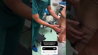 Massive weight loss patient after panniculectomy and gynecomastia repair Resimi