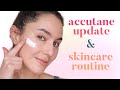 Accutane Update + Skincare Routine 💦 Acne Journey | Karima McKimmie