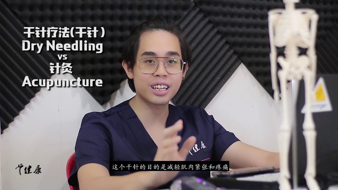 干针疗法与针灸的分别differences Between Dry Needling And Acupuncture Youtube