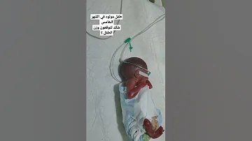 هذا الطفل مولود في الشهر الخامس برئيكم ما هو سبب الولاده في هكذا مده حمل 