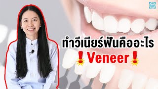 ทำวีเนียร์ฟันคืออะไร ฟันขาวจริงไหม วีเนียร์ฟัน Veneer ไม่รู้อย่าเพิ่งทำ!!