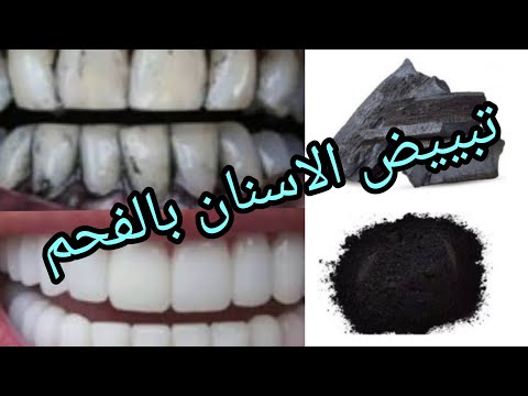 تبييض الاسنان بالفحم والطريقه الصحيحه لاستخدامه