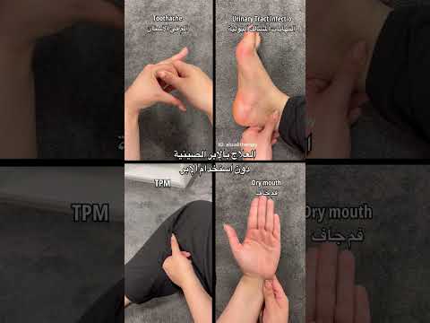 العلاج بالإبر الصينية دون استخدام الإبر