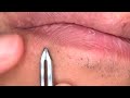 Beard Plucking Under the Mouth - Relaxing ASMR Skincare