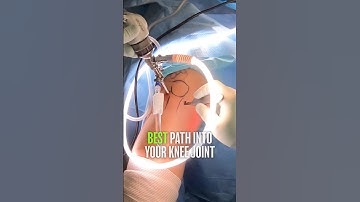 Inside the Operating Room for Knee Surgery⁉️