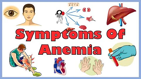 Common Signs & Symptoms Of Anemia |Iron Deficiency, Hemolytic & Other Anemias | Anemia Symptoms - DayDayNews