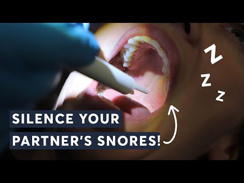 Snoring or Divorce? The Ultimate Solution That's Causing Outrage