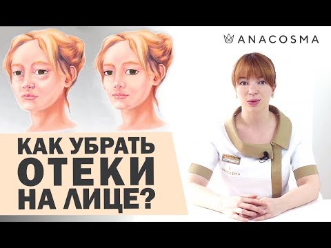 ОТЕКИ | ПРИЧИНЫ ОТЕКОВ | КАК УБРАТЬ МЕШКИ ПОД ГЛАЗАМИ❓