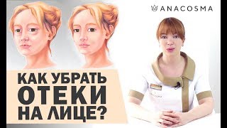 ОТЕКИ | ПРИЧИНЫ ОТЕКОВ | КАК УБРАТЬ МЕШКИ ПОД ГЛАЗАМИ❓