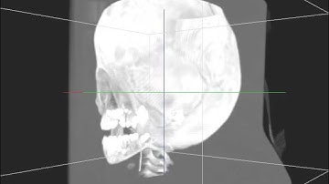 3D Texture Based-Volume Rendering