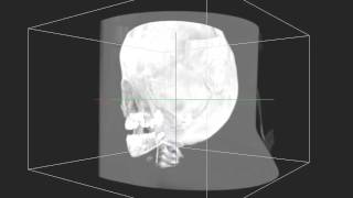 3D Texture Based-Volume Rendering