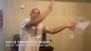 Thyroplasty Surgery