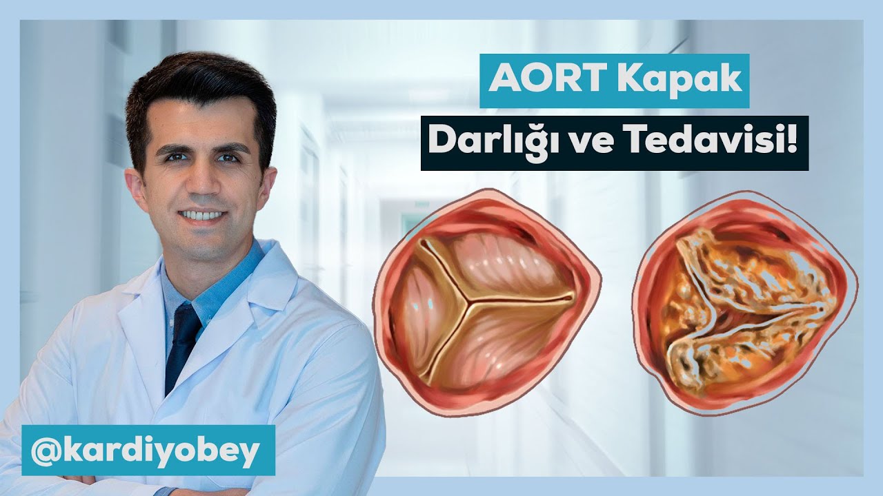 Aort Kapak Daralması ve Yeni Tedavi Yöntemleri