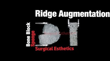 Sponge Graft Ridge Augmentation - Surgical Esthetics