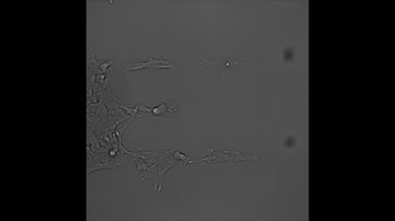 Dynamic control of cell migration - dynamic micropatterning