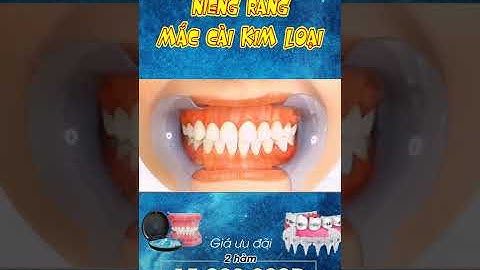 [3D] NIỀNG RĂNG MẮC CÀI KIM LOẠI || Nha Khoa Quốc Tế Athena