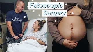 FETOSCOPIC SURGERY VLOG | Closing Baby T's Spine *AMAZING OUTCOME*