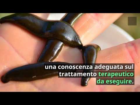 Video: Trattamento Con Sanguisughe (irudoterapia) E Mdash; Visualizzazione Alternativa