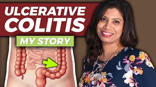 I Was Diagnosed with Ulcerative Colitis... (Dr. Lam's Story)