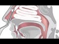 Anterior nasal packing  with ribbon gauge