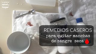 Cómo quitar manchas de sangre seca de la ropa blanca