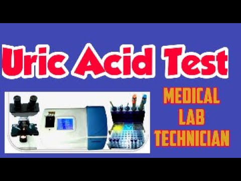 Uric Acid Test  Uric Acid Test Procedure 