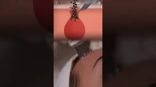 Эффект от ультразвуковой чистки лица!