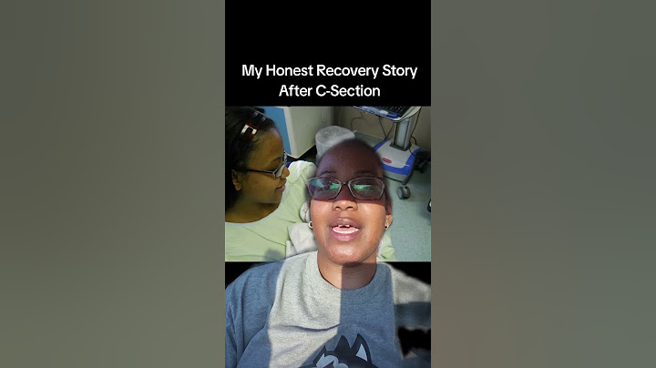 Honest C-Section Recovery Story