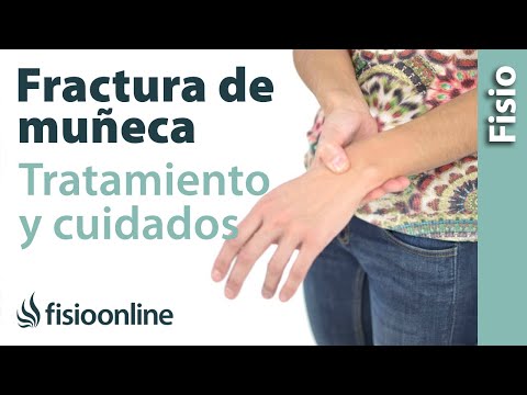 Vídeo: Fractura De Muñeca Desplazada: Síntomas, Tratamiento Y Rehabilitación