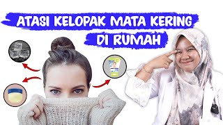 KELOPAK MATA KERING - DOKTER WSP