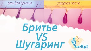 Сравнение бритья и сахарной эпиляции (шугаринга) Сравнение бритья и сахарной эпиляции (шугаринга)