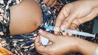 Im Intramuscular Arm Injection Hydrocortisone Injection Tutorial. 24 Ep 91 Anik Health Tips