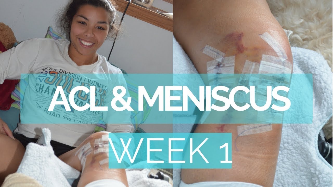 acl-meniscus-recovery-vlog-week-1-post-op-youtube