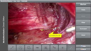 MediaWorkStation Classic - DICOM Worklist