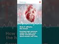 What is Hypertension?