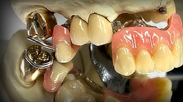 Making Attachments With Me