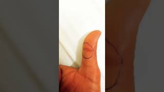 II Benefits of Palmistry II Effects of Island at thumb of our hand II #ytshorts #palmistry #jyotish