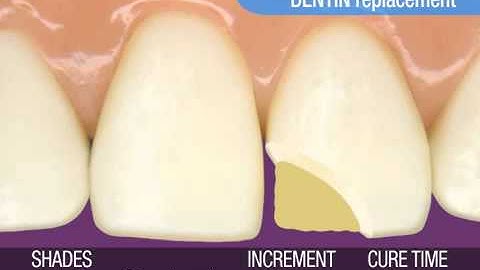 3M ESPE ● Anterior Restorations — Multi-Shade Technique