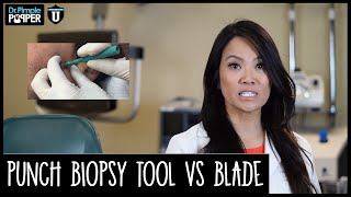 Removing Cysts: Choosing between Punch Tool and Surgical Blade