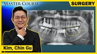 [Master Course Season2 - SURGERY] Autogenous Bone for GBR