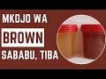 Kukojoa Mkojo Mchafu Mkojo Wa Brown Mara Kwa Mara Dalili Za Mkojo Mchafu Kukojoa Mkojo Mchafu Mkojo Wa Brown Mara Kwa Mara Dalili Za Mkojo Mchafu