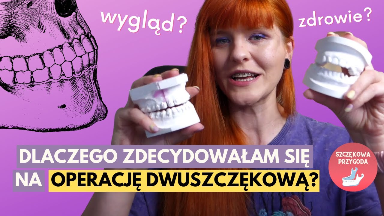 DLACZEGO ZDECYDOWAŁAM SIĘ NA OPERACJĘ SZCZĘKI?